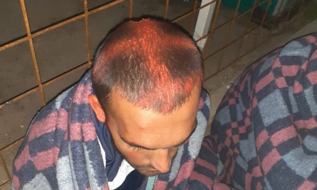 Spray rosso sui capelli dei migranti, il trattamento riservato dalla polizia croata (Fonte: The Guardian)